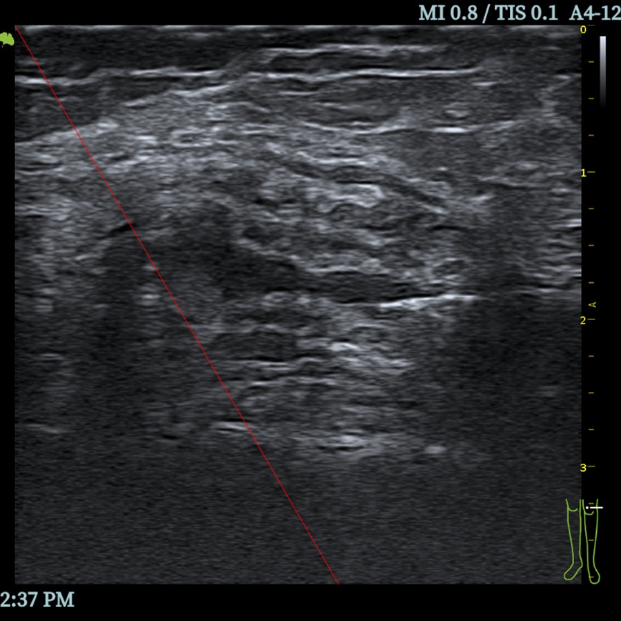 A3 DOPPLER A3 DOPPLER