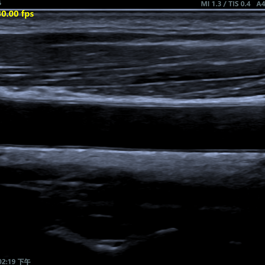 A5 doppler A5 doppler