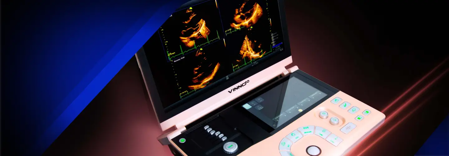 Blog 3. ¿Por qué el sistema de ultrasonido VINNO es la elección perfecta para médicos en México_