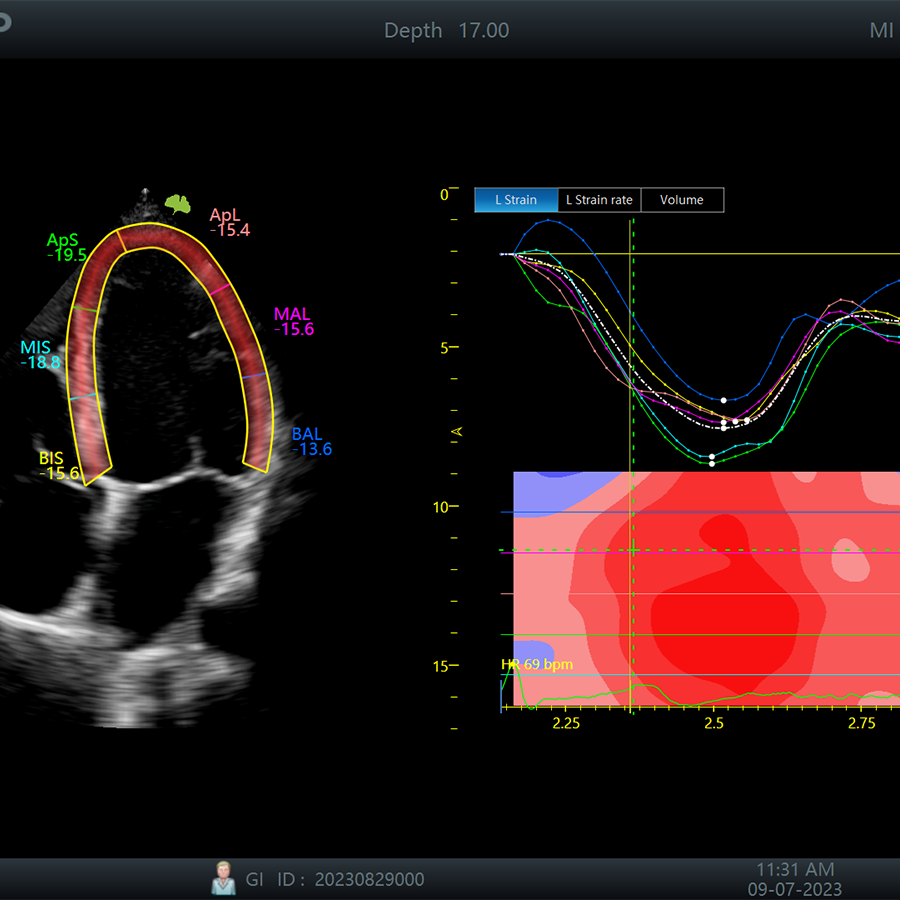 r300 cardio r300 cardio