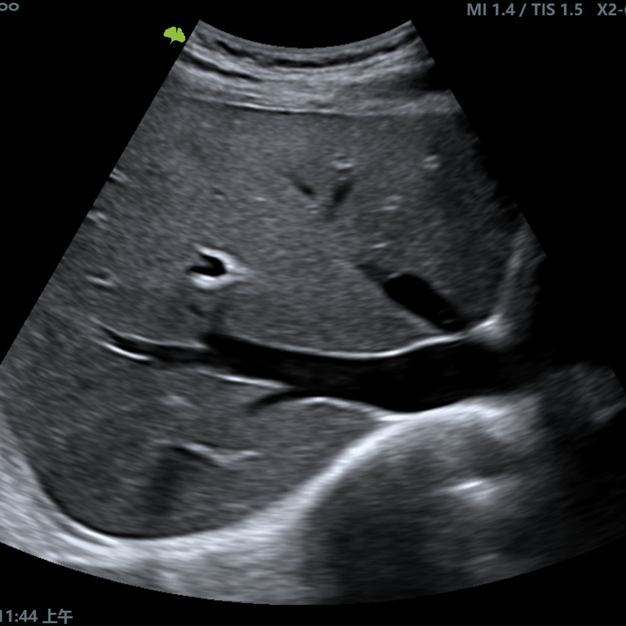 r300 doppler r300 doppler