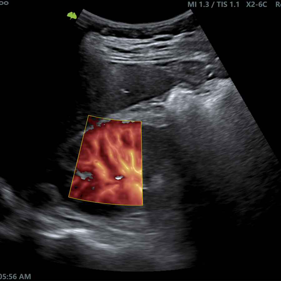 r300 radio r300 radio