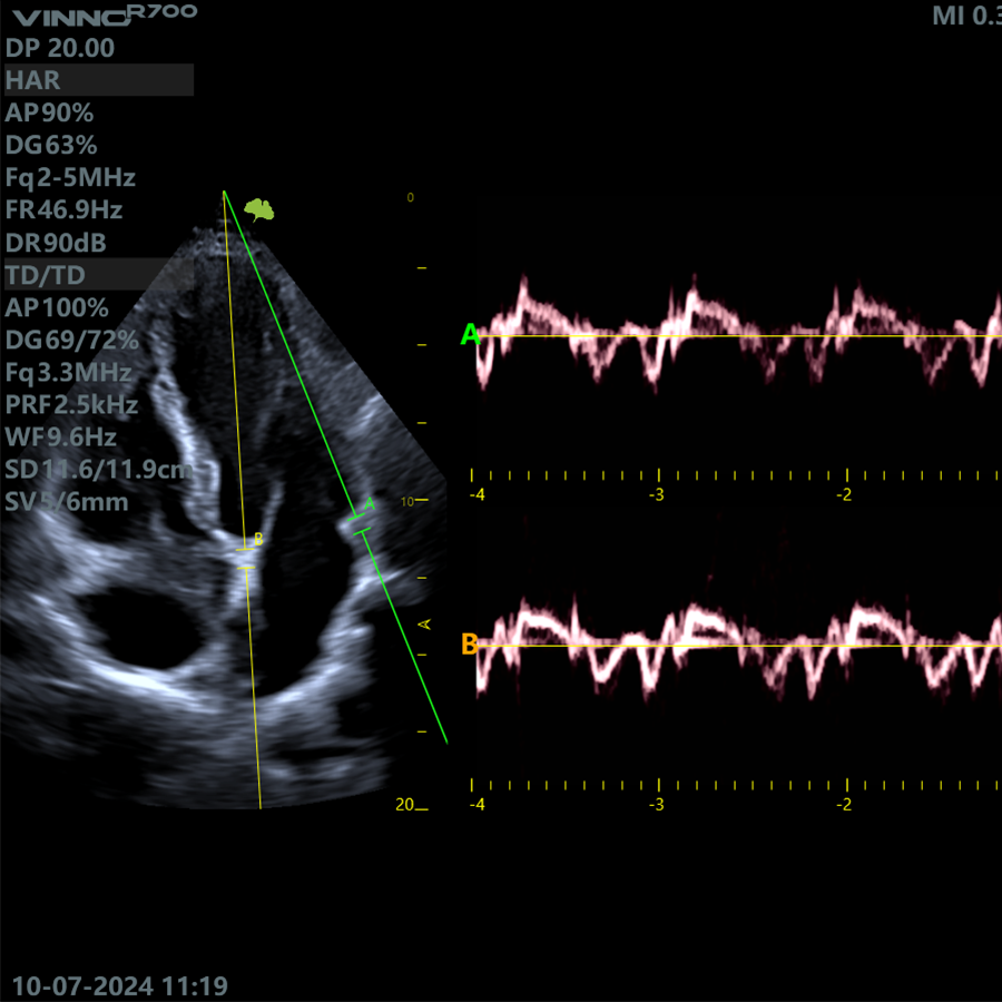 r700 cardio r700 cardio