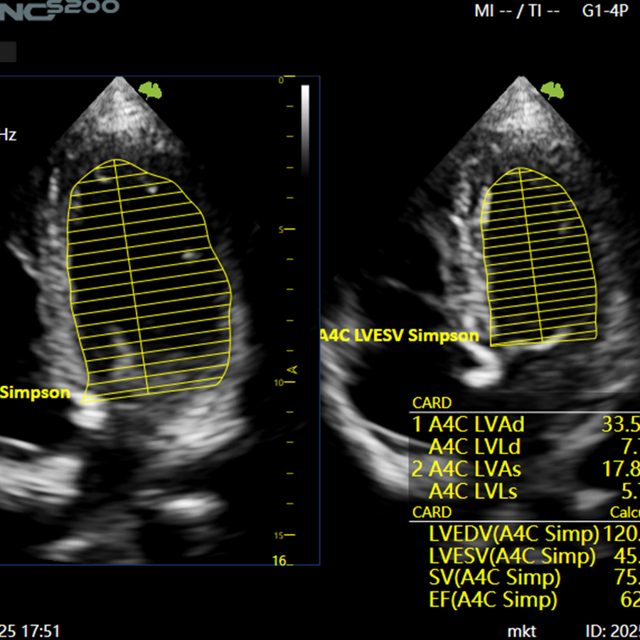 s200 CARDIO s200 CARDIO