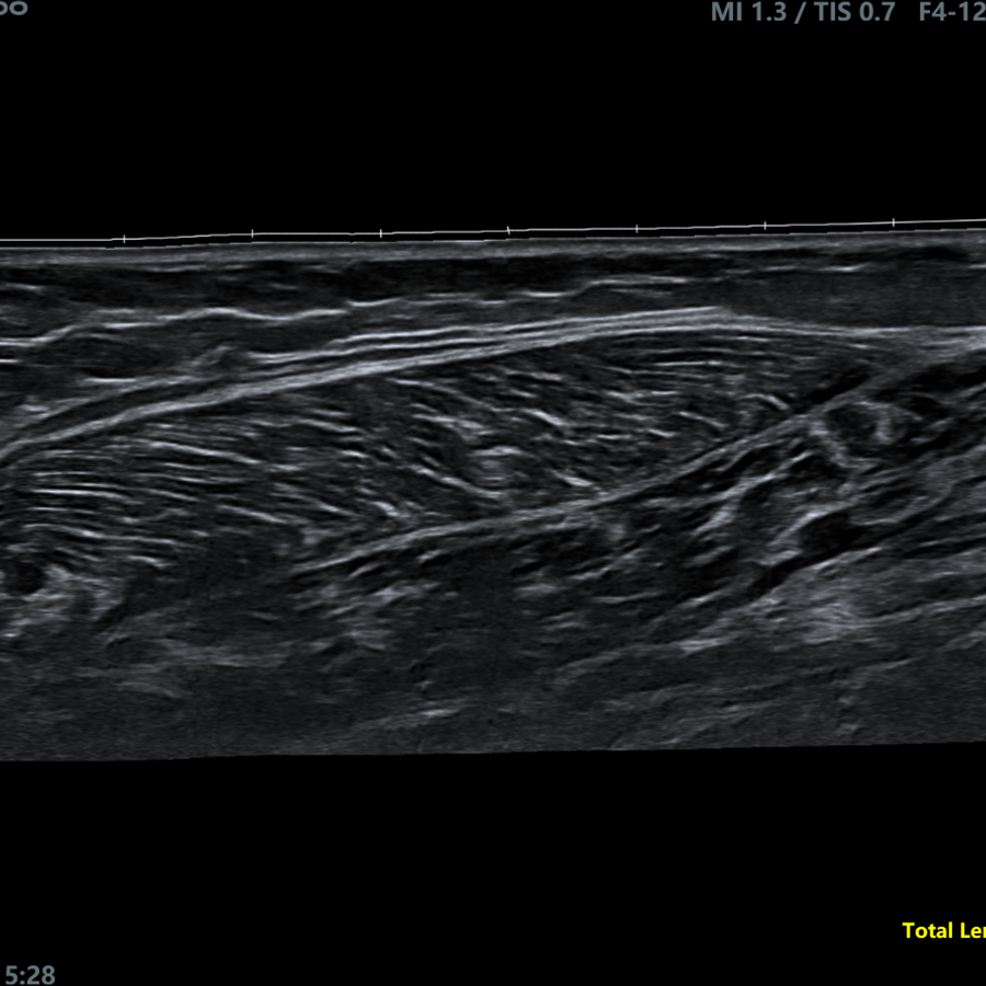 s200 DOPPLER s200 DOPPLER