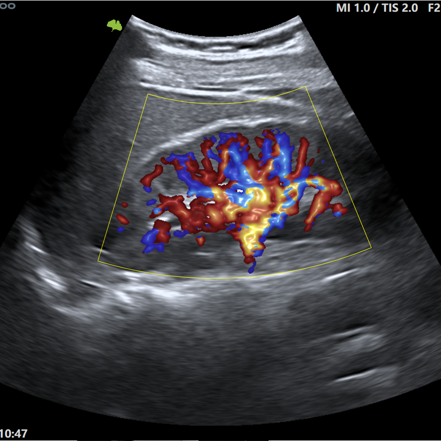 s200 RADIO s200 RADIO