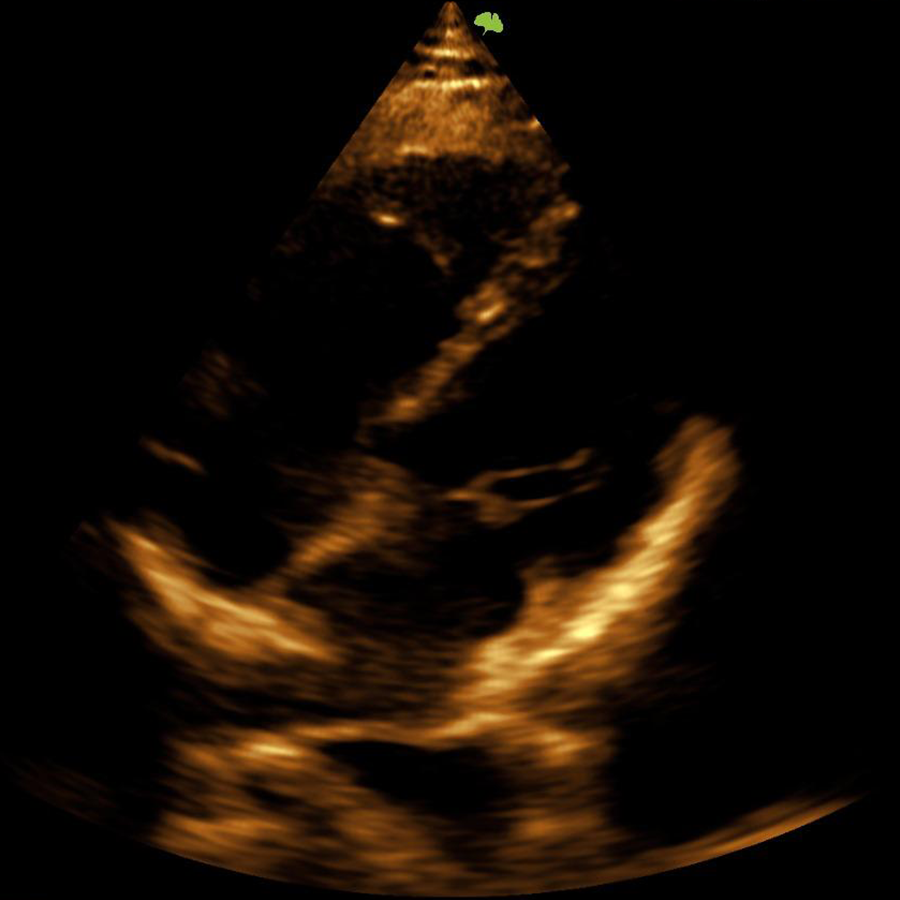 s300 cardio s300 cardio