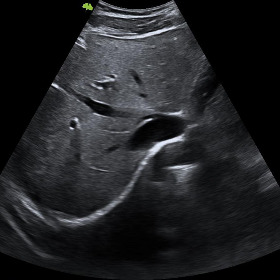 s300 doppler s300 doppler