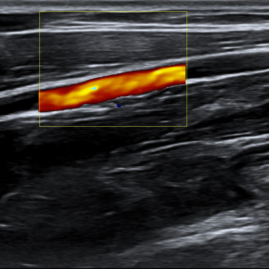 s300 radio s300 radio