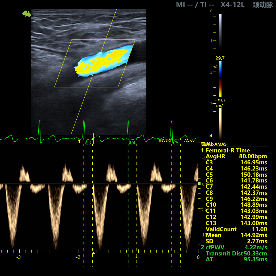 ultimus9e cardio ultimus9e cardio