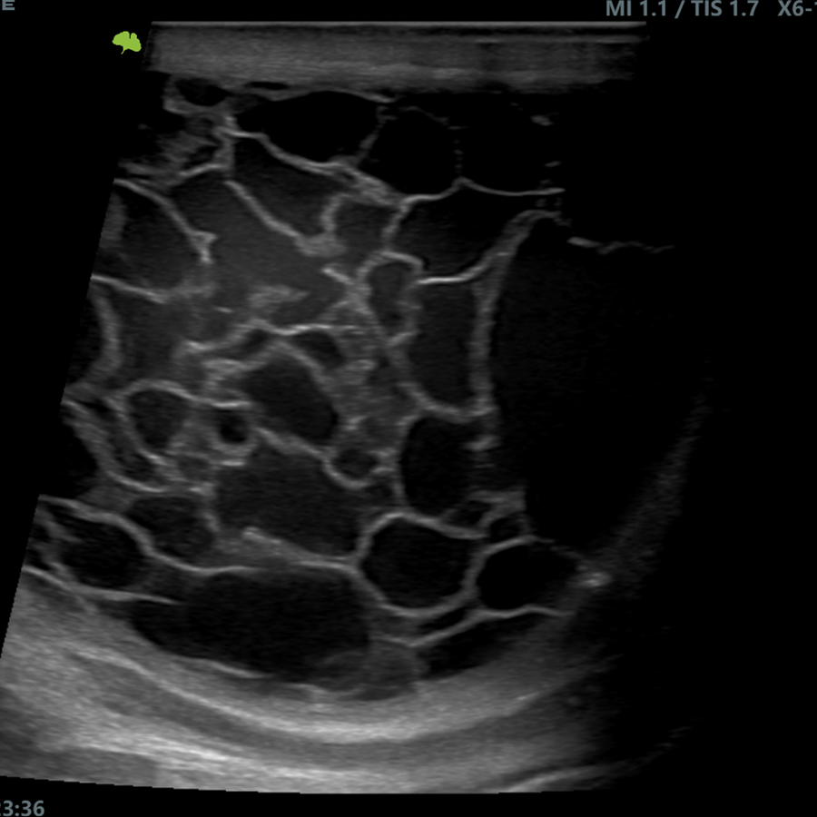 ultimus9e doppler ultimus9e doppler