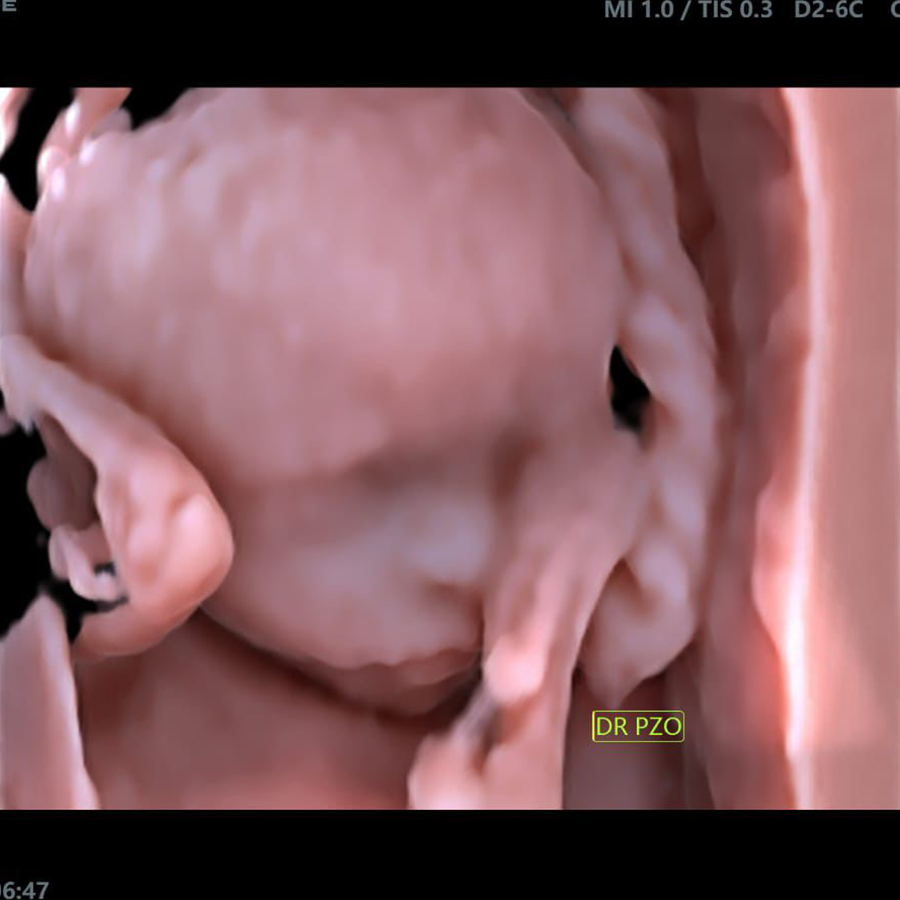 ultimus9e gin ultimus9e gin