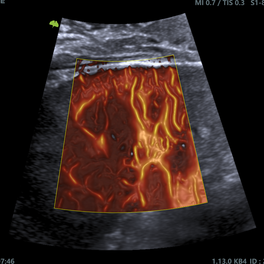 ultimus9e radio ultimus9e radio