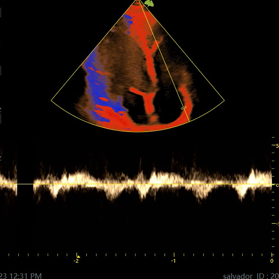 v10 cardio v10 cardio