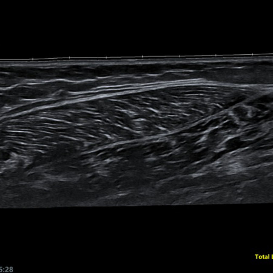 v10 doppler 2 v10 doppler 2